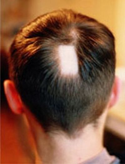 #04 Schalter am Hinterkopf