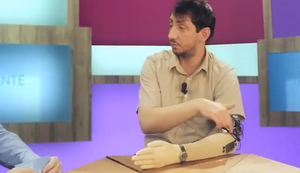 Prothese mit Fehlfunktion