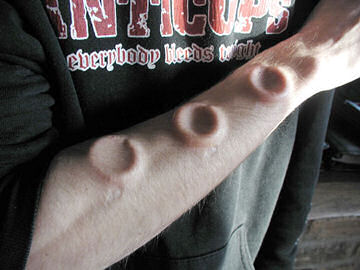 Bizarrer Körperschmuck