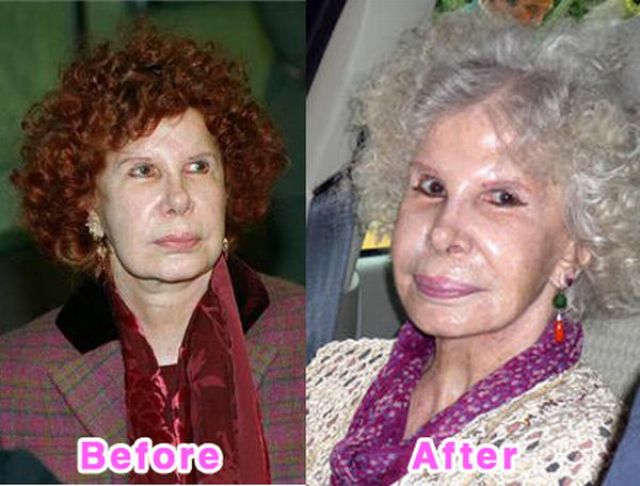 #03 Im Rausch der Schönheit