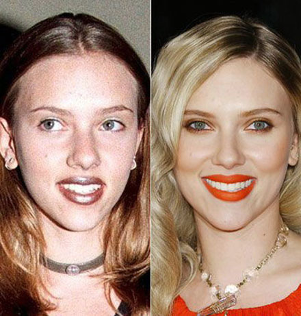 Stars damals und heute