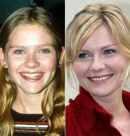 Stars damals und heute