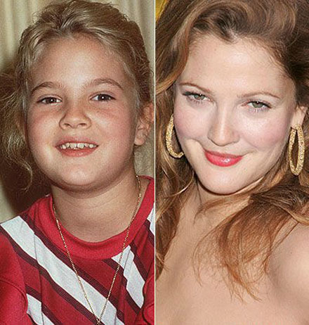 Stars damals und heute