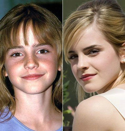 Stars damals und heute