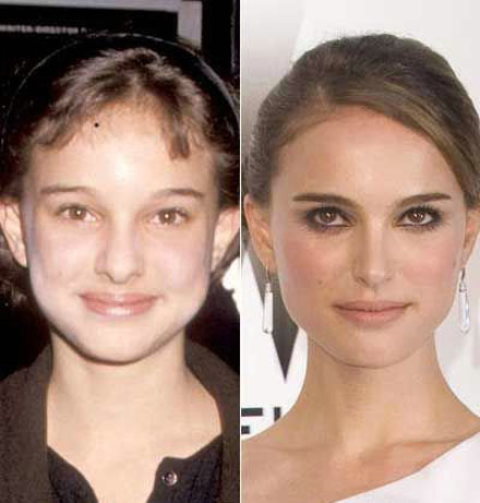 Stars damals und heute