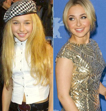 Stars damals und heute