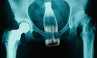 Röntgenbilder von komischen Dingen im Körper